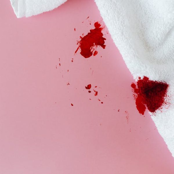 STOP! Mixing Fabuloso and Bleach is Dangerous – Here’s Why